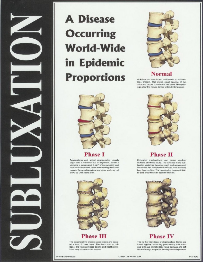 Subluxation Stages