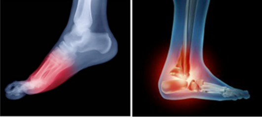 Orthopedic Analysis