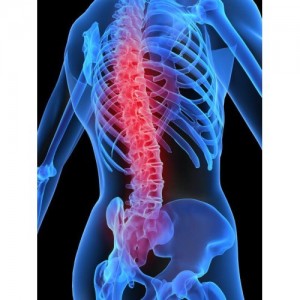 back-pain-solutions-spinal