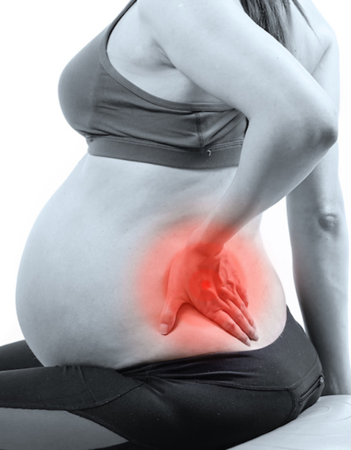 Back pain in pregnancy